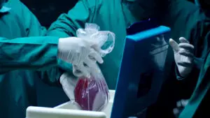 Донорство тканей и органов человека пгсле смерти